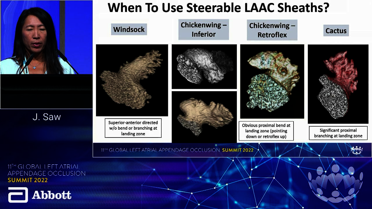 LAAO 22: New delivery systems