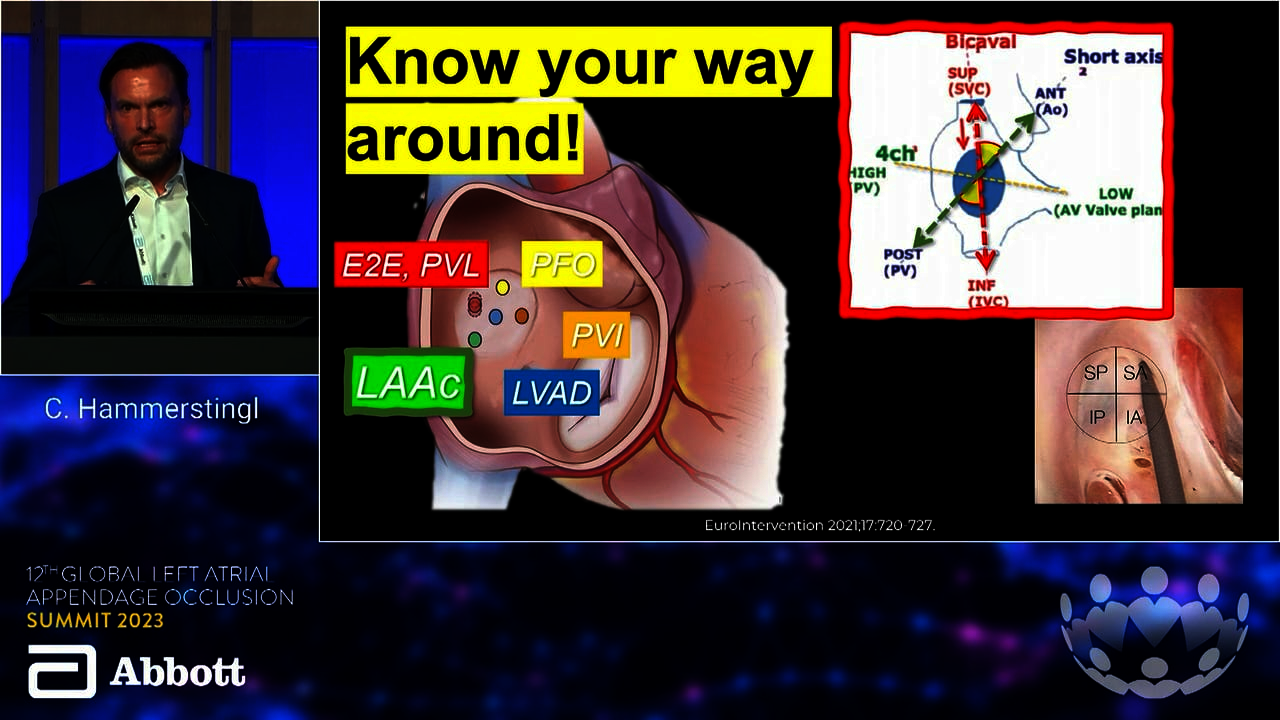 LAAO 23: Anatomy & Imaging - CT