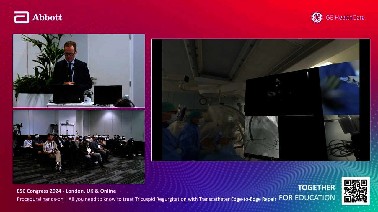 250623_ABBOTT_ESC_LONDON_TRICUSPID_EP_2