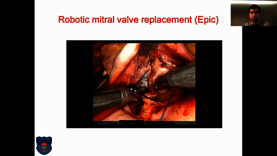 Webinar 2022: Management of aortic and mitral valve disease
