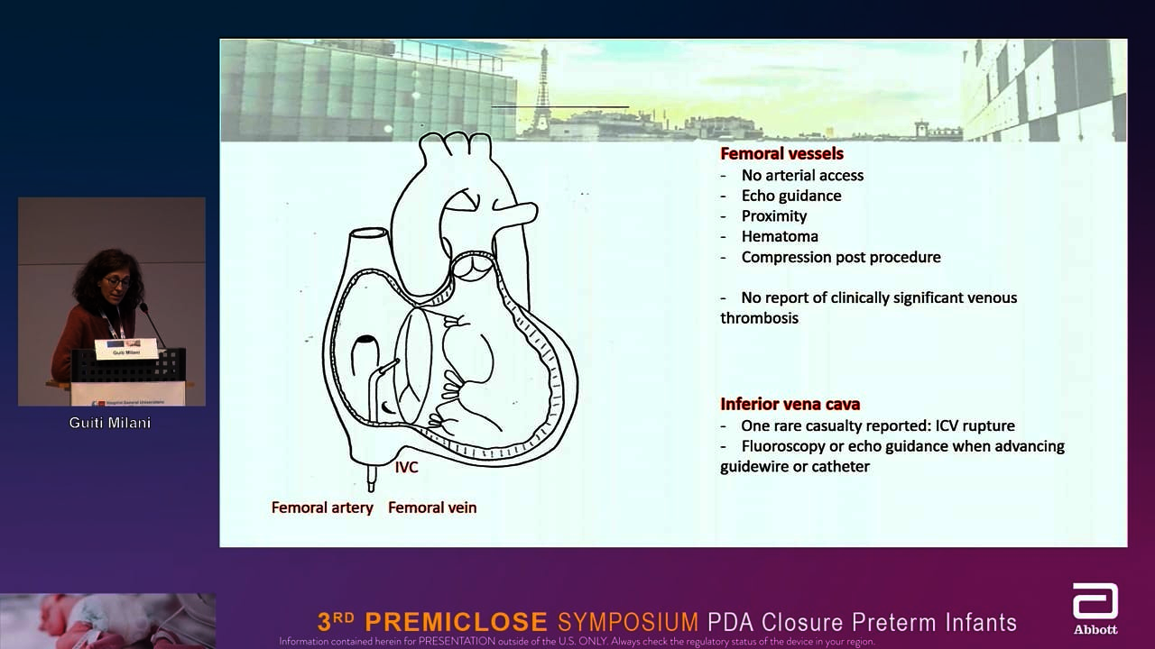 Premiclose 22: Complications in PDA closure