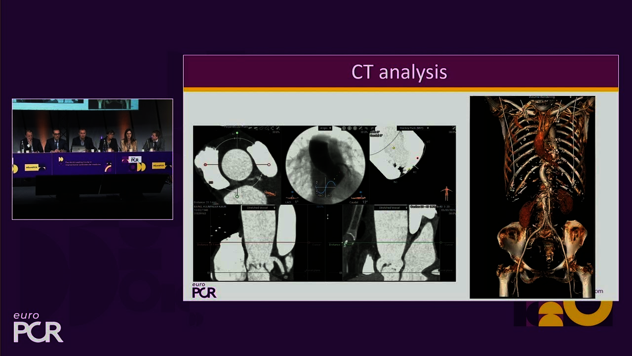 Optimising self-expandable TAVI clinical outcomes without compromise - EuroPCR 2025