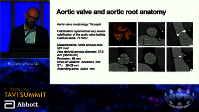 TAVI 23: Calcified valve
