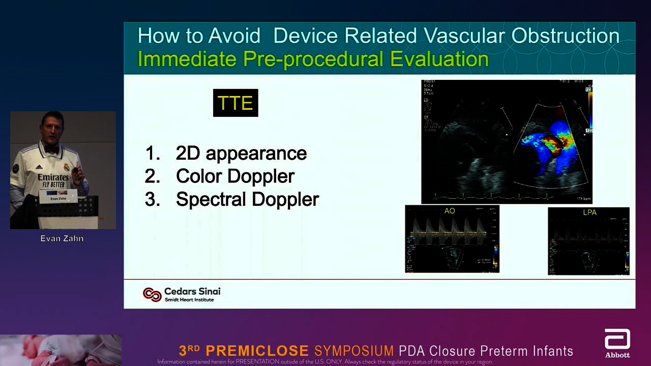 Premiclose 22: Midterm evolution of PDA