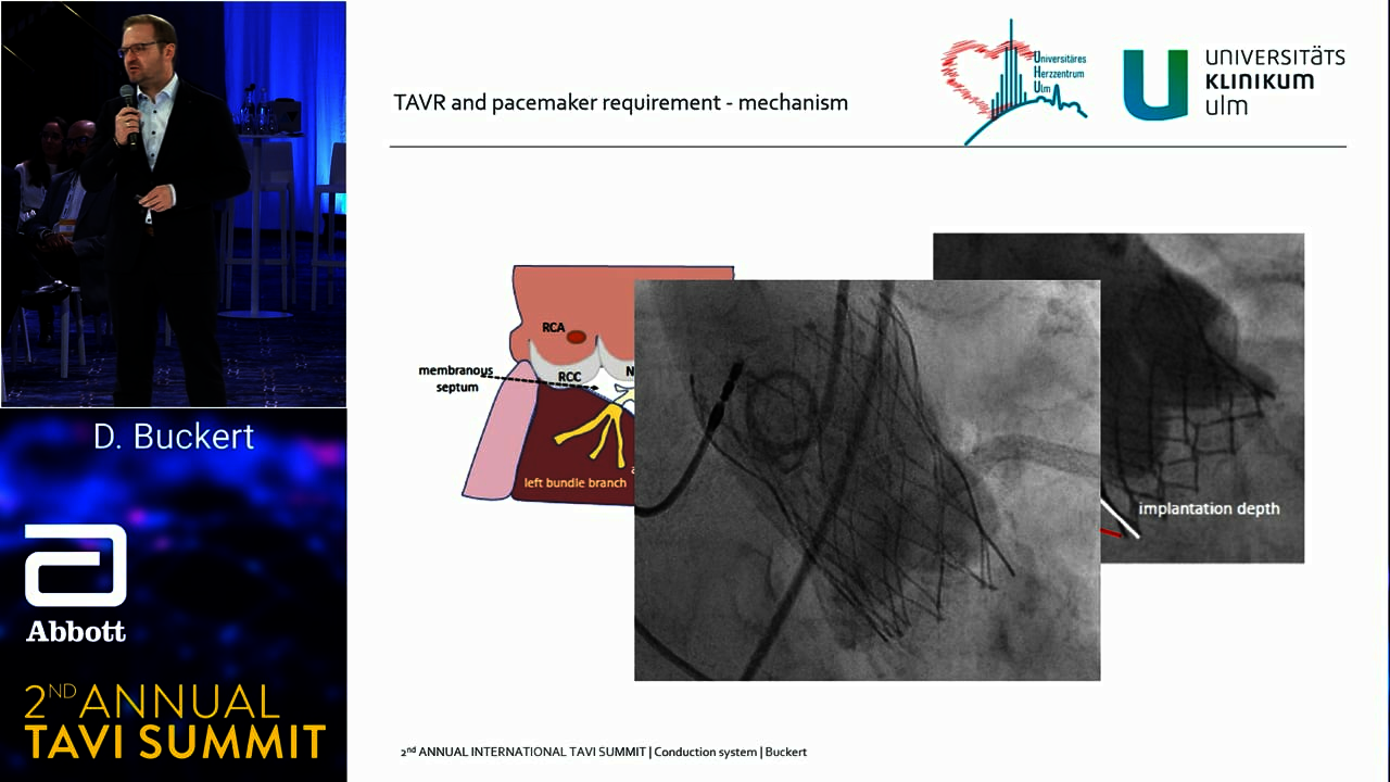 TAVI Summit - Cardiac imaging