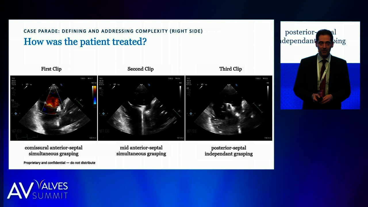 Live Case: T-TEER