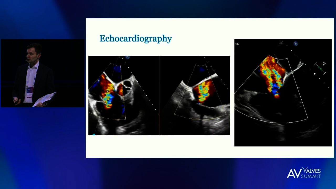 Review the Trends | Tricuspid focus