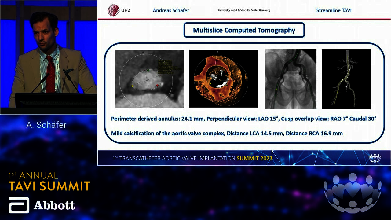 TAVI 23: Streamlining implantation