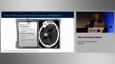 ESOC 23: AF patient LAA case