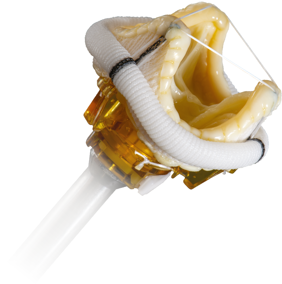 Epic Plus Supra mitral stented tissue valve features